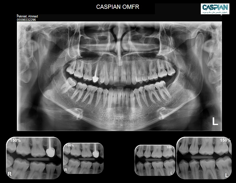 نمونه تصاویر